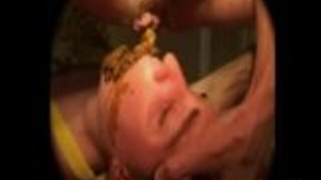 Shit On The Face