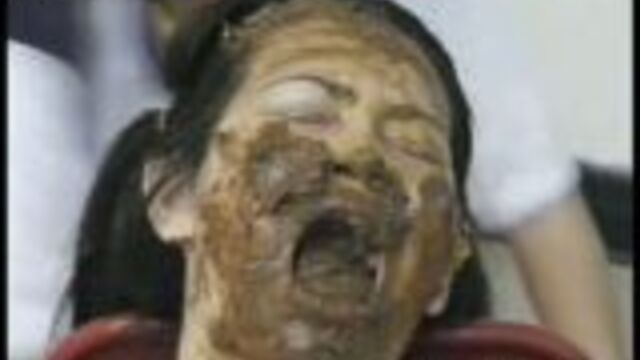 Aftermath Of Forced Shit Eating