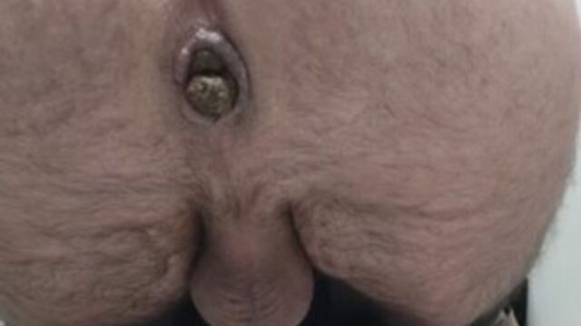 Public toilet Spy Cam