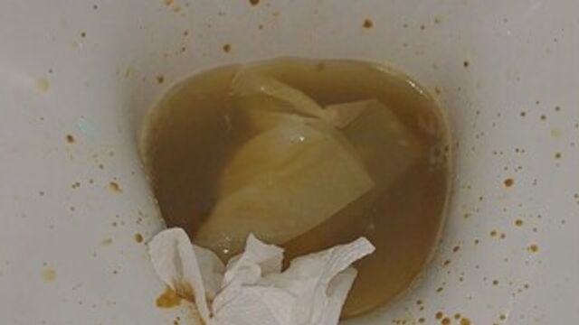 You LOVE my POO