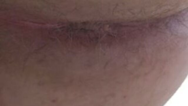 Amateur poo